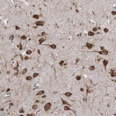 Immunohistochemistry-Paraffin: CCDC47 Antibody [NBP1-93717] - Staining of human Cerebral cortex shows strong granular cytoplasmic positivity in neuronal cells.