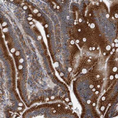 Immunohistochemistry-Paraffin: CCDC47 Antibody [NBP1-93717] - Staining of human Duodenum shows strong granular cytoplasmic positivity in glandular cells.