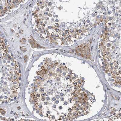 Immunohistochemistry-Paraffin: CCDC47 Antibody [NBP1-93717] - Staining of human Testis shows moderate granular cytoplasmic positivity in cells in seminiferous ducts and leydig cells.