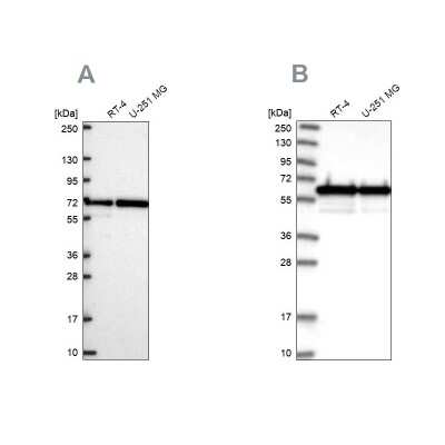 Western Blot: CCDC47 Antibody [NBP2-56445] - Analysis using Anti-CCDC47 antibody NBP2-56445 (A) shows similar pattern to independent antibody NBP1-93717 (B).