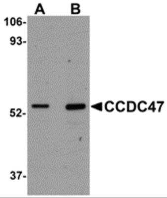 Western Blot: CCDC47 Antibody [NBP2-82077] - Analysis of CCDC47 in mouse heart tissue lysate with CCDC47 antibody at (A) 1 and (B) 2 ug/ml.