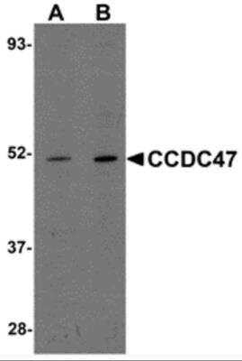 Western Blot: CCDC47 Antibody [NBP2-82078] - Analysis of CCDC47 in mouse heart tissue lysate with CCDC47 antibody at (A) 1 and (B) 2 ug/ml.