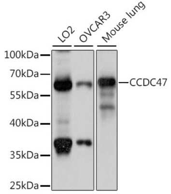 Western Blot: CCDC47 Antibody [NBP2-92269] - Analysis of extracts of various cell lines, using CCDC47 at 1:1000 dilution.Secondary antibody: HRP Goat Anti-Rabbit IgG (H+L) at 1:10000 dilution.Lysates/proteins: 25ug per lane.Blocking buffer: 3% nonfat dry milk in TBST.Detection: ECL Basic Kit .Exposure time: 3s.