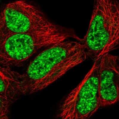 Immunocytochemistry/ Immunofluorescence CCDC49 Antibody