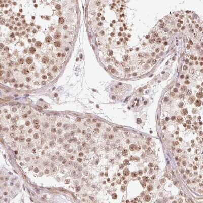 Immunohistochemistry-Paraffin: CCDC49 Antibody [NBP2-49381] - Staining of human testis shows moderate nuclear positivity in cells in seminiferus ducts.