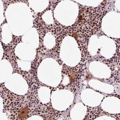 Immunohistochemistry-Paraffin CCDC49 Antibody