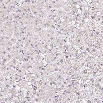 Immunohistochemistry-Paraffin CCDC49 Antibody