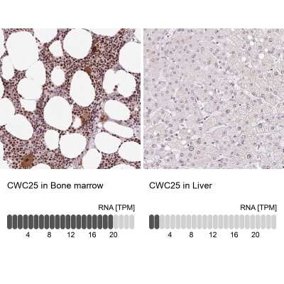 Immunohistochemistry-Paraffin: CCDC49 Antibody [NBP2-49381] - Staining in human bone marrow and liver tissues using anti-CWC25 antibody. Corresponding CWC25 RNA-seq data are presented for the same tissues.