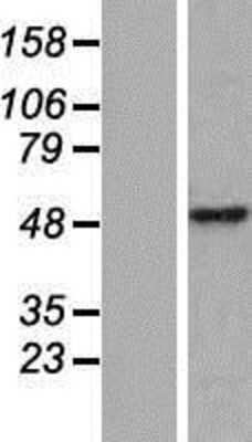 Western Blot: CCDC49 Overexpression Lysate (Adult Normal) [NBP2-06931] Left-Empty vector transfected control cell lysate (HEK293 cell lysate); Right -Over-expression Lysate for CCDC49.