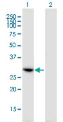 Western Blot: CCDC5 Antibody (1E3) [H00115106-M01] - Analysis of CCDC5 expression in transfected 293T cell line by CCDC5 monoclonal antibody (M01), clone 1E3.Lane 1: CCDC5 transfected lysate (Predicted MW: 31.9 KDa).Lane 2: Non-transfected lysate.
