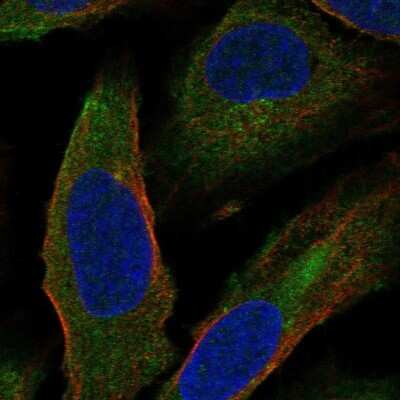 Immunocytochemistry/Immunofluorescence: CCDC5 Antibody [NBP1-88159] - Staining of human cell line U-2 OS shows localization to cytosol & centrosome. Antibody staining is shown in green.