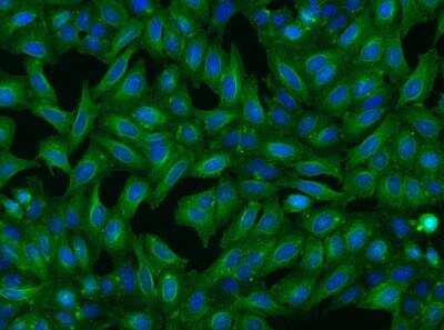Immunocytochemistry/Immunofluorescence: CCDC5 Antibody [NBP3-06419] - Immunofluorescence staining of CCDC5 in U2OS cells. Cells were fixed with 4% PFA, permeabilzed with 0.1% Triton X-100 in PBS,blocked with 10% serum, and incubated with CCDC5 Antibody (dilution ratio 1:200) at 4 degrees celsius overnight. Then cells were stained with the Alexa Fluor (TM) 488-conjugated Goat Anti-rabbit IgG secondary antibody (green) and counterstained with DAPI (blue).Positive staining was localized to Cytoplasm.