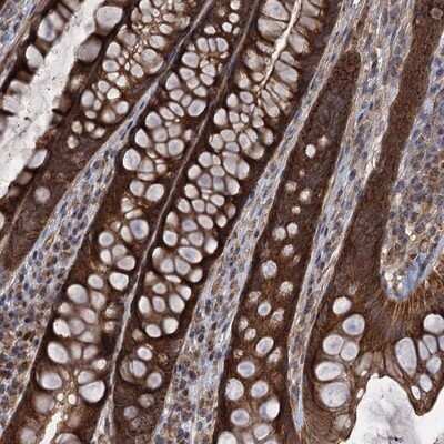 <b>Independent Antibodies Validation. </b>Immunohistochemistry-Paraffin: CCDC5 Antibody [NBP1-88158] - Staining of human rectum shows strong cytoplasmic positivity in glandular cells.