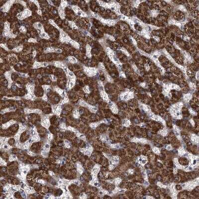 Immunohistochemistry-Paraffin: CCDC5 Antibody [NBP1-88159] - Staining of human liver shows strong cytoplasmic positivity in hepatocytes.