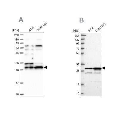 Western Blot CCDC5 Antibody - BSA Free