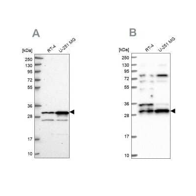 Western Blot: CCDC5 Antibody [NBP1-88159] - Analysis using Anti-HAUS1 antibody NBP1-88159 (A) shows similar pattern to independent antibody NBP1-88158 (B).