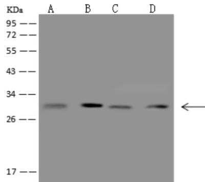 Western Blot: CCDC5 Antibody [NBP3-06419] - CCDC5 antibody at 1:500 dilution. Lane A: HL60 Whole Cell Lysate Lane B: U937 Whole Cell Lysate Lane C: MOLT4 Whole Cell Lysate Lane D: Daudi Whole Cell Lysate. Lysates/proteins at 30 ug per lane. Secondary: Goat Anti-Rabbit IgG (H+L)/HRP at 1/10000 dilution. Developed using the ECL technique. Performed under reducing conditions. Observed band size:32 kDa
