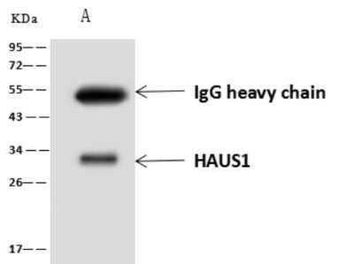 Western Blot CCDC5 Antibody - BSA Free