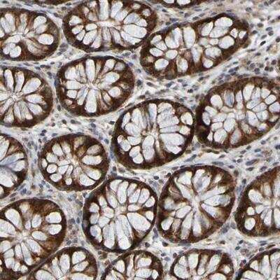 Immunohistochemistry-Paraffin: CCDC51 Antibody [NBP1-82302] - Staining of human colon shows strong cytoplasmic positivity in glandular cells.