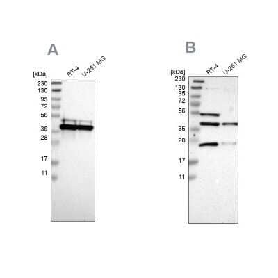 Western Blot: CCDC51 Antibody [NBP1-82303] - Analysis using Anti-CCDC51 antibody NBP1-82303 (A) shows similar pattern to independent antibody NBP1-82302 (B).