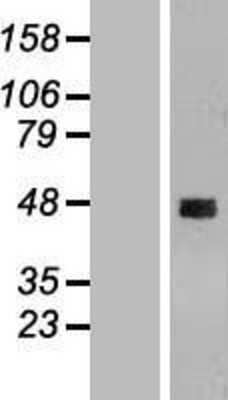 Western Blot: CCDC51 Overexpression Lysate (Adult Normal) [NBL1-08802] Left-Empty vector transfected control cell lysate (HEK293 cell lysate); Right -Over-expression Lysate for CCDC51.