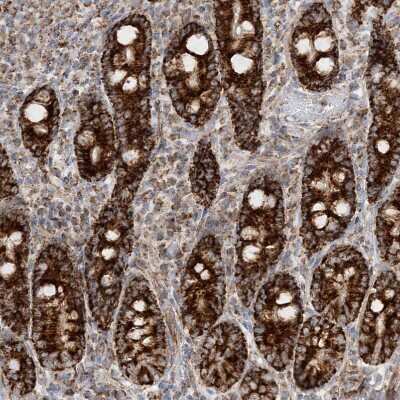 Immunohistochemistry-Paraffin CCDC56 Antibody - BSA Free