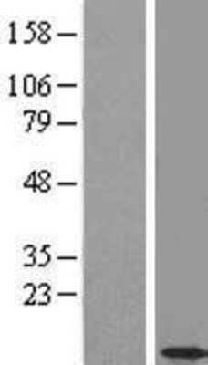 Western Blot: CCDC56 Overexpression Lysate (Adult Normal) [NBL1-08806] Left-Empty vector transfected control cell lysate (HEK293 cell lysate); Right -Over-expression Lysate for CCDC56.