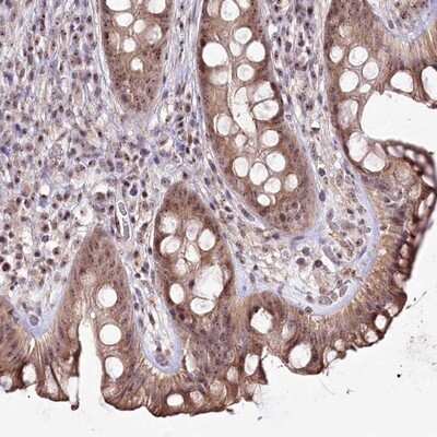 Immunohistochemistry-Paraffin: CCDC59 Antibody [NBP1-88368] - Staining of human rectum shows moderate cytoplasmic and nucleolar positivity in glandular cells.