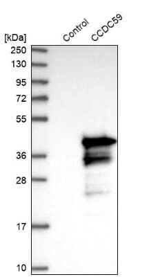 Western Blot: CCDC59 Antibody [NBP1-88368] - Analysis in control (vector only transfected HEK293T lysate) and CCDC59 over-expression lysate (Co-expressed with a C-terminal myc-DDK tag (3.1 kDa) in mammalian HEK293T cells).