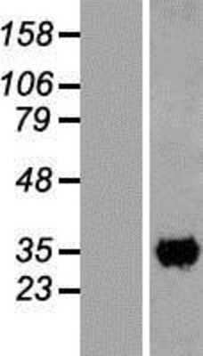 Western Blot: CCDC59 Overexpression Lysate (Adult Normal) [NBL1-08809] Left-Empty vector transfected control cell lysate (HEK293 cell lysate); Right -Over-expression Lysate for CCDC59.