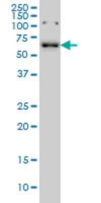 Western Blot: CCDC6 Antibody (5D11) [H00008030-M03] - Analysis of CCDC6 expression in K-562 (Cat # L009V1).