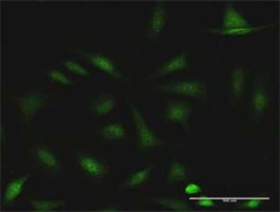 Immunocytochemistry/Immunofluorescence: CCDC6 Antibody [H00008030-D01P] - Analysis of antibody to CCDC6 on HeLa cell. Antibody concentration 10 ug/ml.