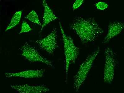 Immunocytochemistry/Immunofluorescence: CCDC6 Antibody [NBP2-98985] - Immunofluorescence staining of CCDC6 in HeLa cells. Cells were fixed with 4% PFA, permeabilzed with 0.3% Triton X-100 in PBS, blocked with 10% serum, and incubated with rabbit anti-Human CCDC6 polyclonal antibody (dilution ratio 1:1000) at 4C overnight. Then cells were stained with the Alexa Fluor$488-conjugated Goat Anti-rabbit IgG secondary antibody (green). Positive staining was localized to cytoplasm and nucleus.