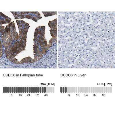 <b>Orthogonal Strategies Validation. </b>Immunohistochemistry-Paraffin: CCDC6 Antibody [NBP1-85350] - Analysis in human fallopian tube and liver tissues. Corresponding CCDC6 RNA-seq data are presented for the same tissues.