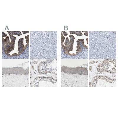 <b>Independent Antibodies Validation. </b>Immunohistochemistry-Paraffin: CCDC6 Antibody [NBP1-85350] - Staining of human fallopian tube, liver, skin and testis using Anti-CCDC6 antibody NBP1-85350 (A) shows similar protein distribution across tissues to independent antibody NBP1-85351 (B).