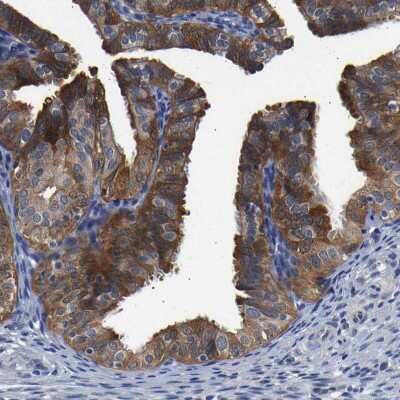 Immunohistochemistry-Paraffin: CCDC6 Antibody [NBP1-85350] - Staining of human Fallopian tube shows strong cytoplasmic positivity in glandular cells.