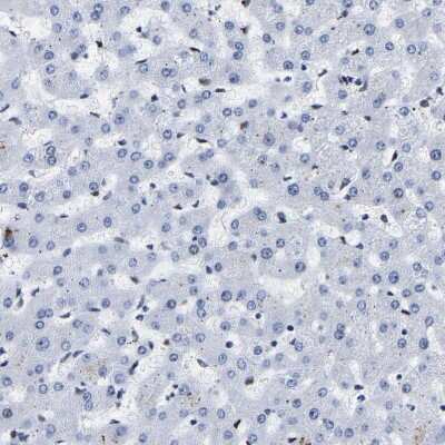 Immunohistochemistry-Paraffin: CCDC6 Antibody [NBP1-85350] - Staining of human liver shows no positivity in hepatocytes as expected.