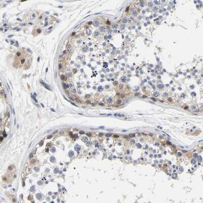 Immunohistochemistry-Paraffin: CCDC6 Antibody [NBP1-85350] - Staining of human testis shows weak to moderate cytoplasmic positivity in cells in seminiferous ducts.