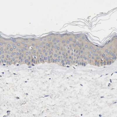 Immunohistochemistry-Paraffin: CCDC6 Antibody [NBP1-85350] - Staining of human skin shows weak cytoplasmic positivity in squamous epithelial cells.