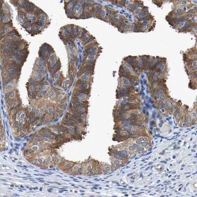 Immunohistochemistry-Paraffin: CCDC6 Antibody [NBP1-85351] - Staining of human Fallopian tube shows strong cytoplasmic positivity in glandular cells.