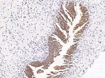 Immunohistochemistry-Paraffin: CCDC6 Antibody [NBP2-98985] - Immunochemical staining of human CCDC6 in human urinary bladder with rabbit polyclonal antibody (1:500, formalin-fixed paraffin embedded sections).