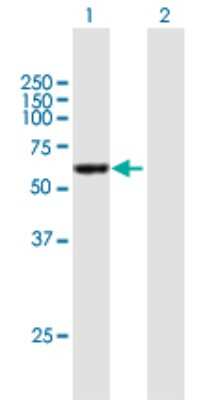 Western Blot: CCDC6 Antibody [H00008030-B01P] - Analysis of CCDC6 expression in transfected 293T cell line by CCDC6 polyclonal antibody.  Lane 1: CCDC6 transfected lysate(52.14 KDa). Lane 2: Non-transfected lysate.