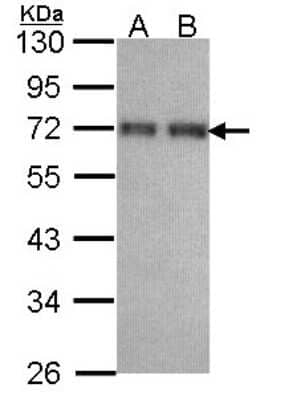 Western Blot: CCDC6 Antibody [NBP1-31882] - Sample (30 ug of whole cell lysate) A: H1299 B: Hela 10% SDS PAGE; antibody diluted at 1:1000.