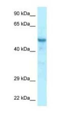 Western Blot: CCDC6 Antibody [NBP1-98370] - Titration: 1.0 ug/ml Positive Control: Mouse Liver.