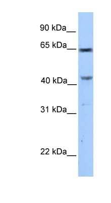 Western Blot: CCDC60 Antibody [NBP1-56747] - MCF-7 whole cell lysates, concentration 0.2-1 ug/ml.