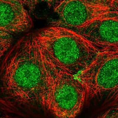 Immunocytochemistry/Immunofluorescence: CCDC64 Antibody [NBP2-56736] - Staining of human cell line MCF7 shows localization to nucleoplasm & cytosol.
