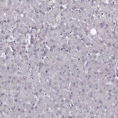 Immunohistochemistry-Paraffin: CCDC64 Antibody [NBP2-56736] - Staining of human liver shows low expression as expected.