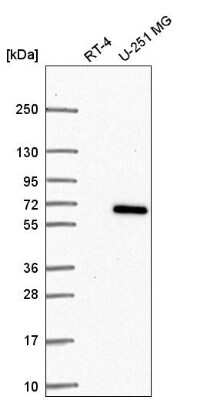 Western Blot: CCDC64 Antibody [NBP2-56736] - Western blot analysis in human cell line RT-4 and human cell line U-251 MG.