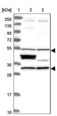 Western Blot: CCDC64B Antibody [NBP1-90963] - Lane 1: Marker  [kDa] 250, 130, 95, 72, 55, 36, 28, 17, 10.  Lane 2: Human cell line RT-4.  Lane 3: Human cell line U-251MG sp
