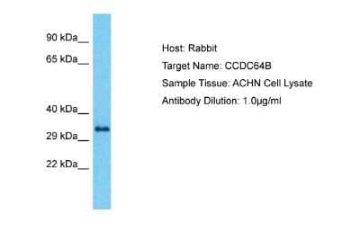 Western Blot: CCDC64B Antibody [NBP2-82608] - Host: Rabbit. Target Name: CCDC64B. Sample Type: ACHN Whole cell lysates. Antibody Dilution: 1.0ug/ml